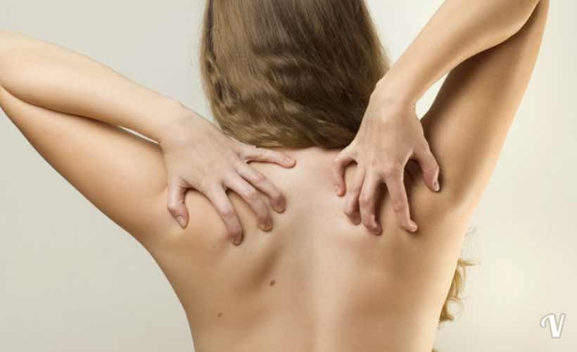 Rimedi Naturali Irritazione Pelle