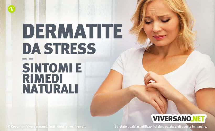 dermatite da stress cura
