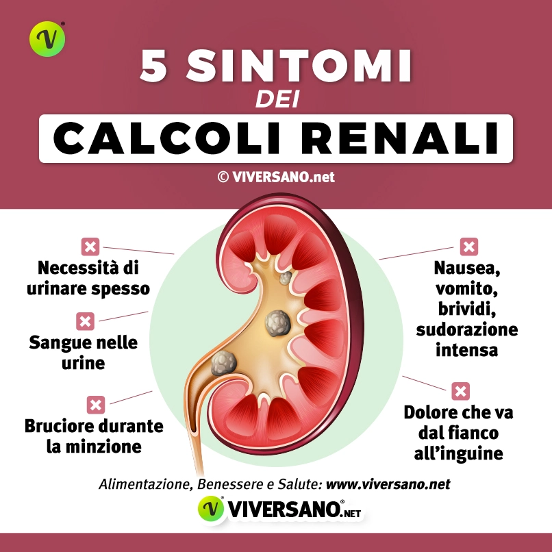 Infografica su 5 sintomi di calcoli ai reni